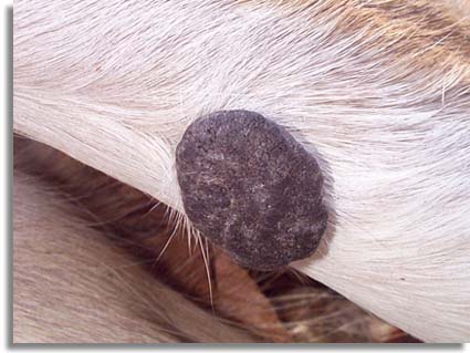 Deer Warts - Cutaneous fibromas